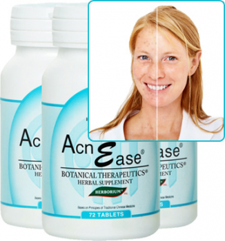 Female Hormonal Acne